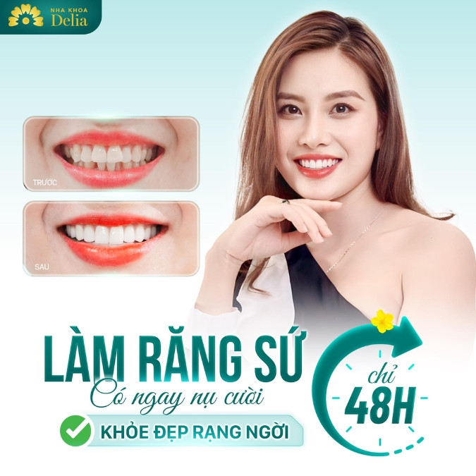 Các mẹ nên bọc sứ trong trường hợp nào? Những trường hợp nào nên bọc răng sứ?