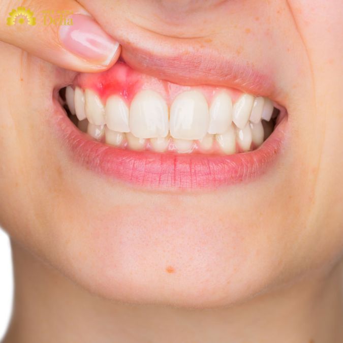 Chân răng ê buốt tiềm ẩn bệnh lý về răng miệng