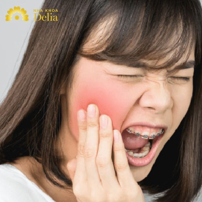 Nhai thức ăn quá cứng gây ra tình trạng đau chân răng hàm trên