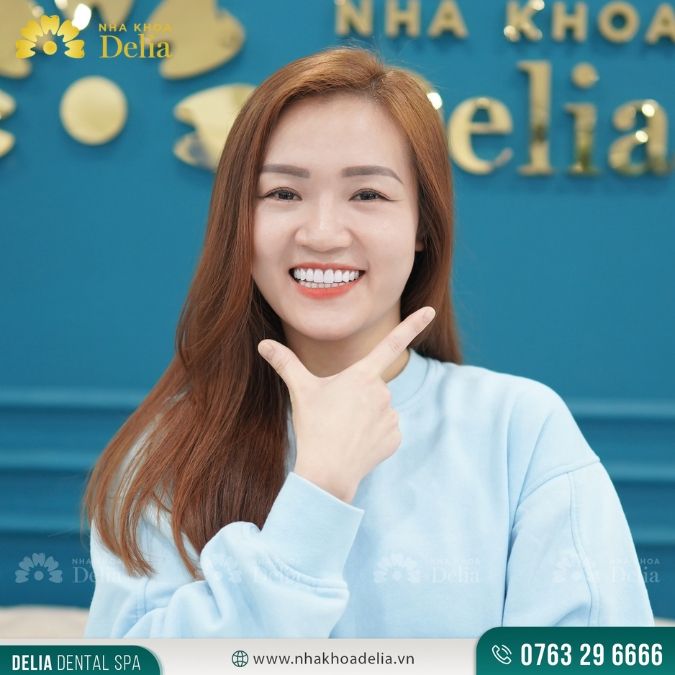 Bảng giá bọc răng sứ tại Hà Nội | Cập nhật mới nhất 2023