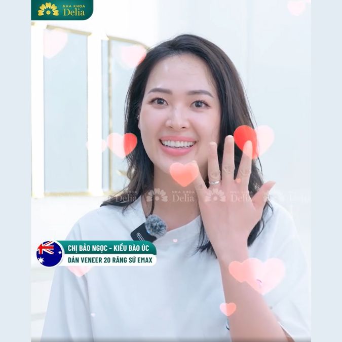 Khách hàng Bảo Ngọc rạng rỡ sau dán Veneer 20 răng sứ Emax