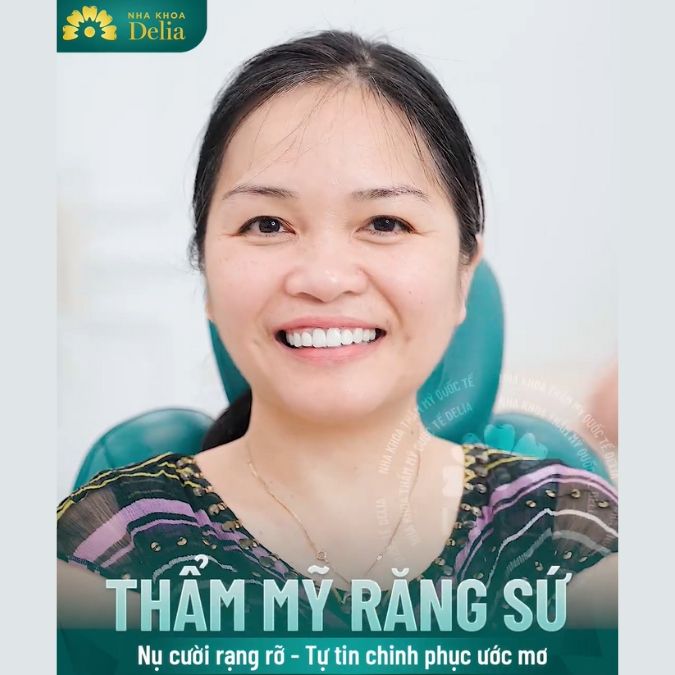 Khách hàng Bùi Thị Thủy trải nghiệm làm răng sứ Emax tại nha khoa Delia