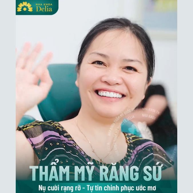 Khách hàng Bùi Thị Thủy trước và sau khi thẩm mỹ 18 răng sứ Emax