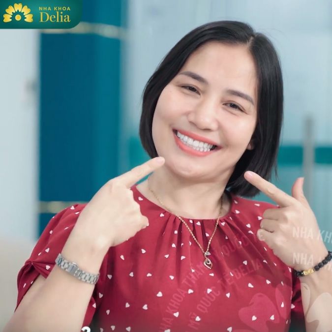 Khách hàng Trịnh Huyền sau khi thẩm mỹ 23 răng sứ HT Smile