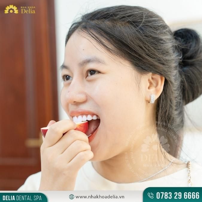 Làm răng sứ 4 răng cửa ăn nhai có tốt không?