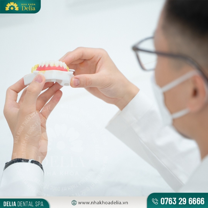 Quy trình bọc sứ cho răng hô chuẩn y khoa