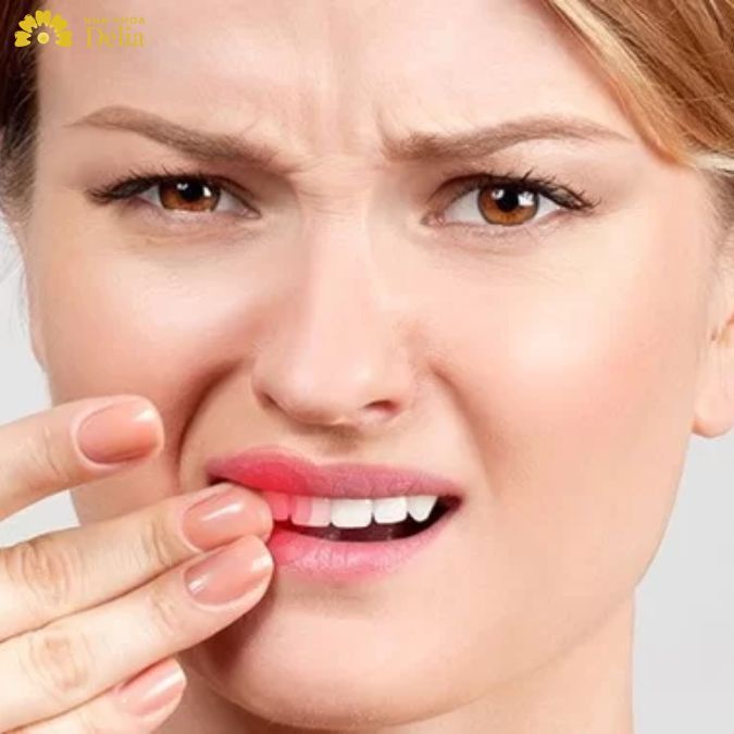 Răng có tiền sử bệnh lý nghiêm trọng khó có thể thẩm mỹ răng sứ