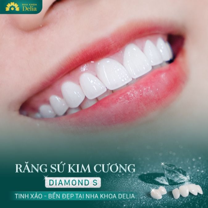 Trám răng hay bọc sứ cho răng sâu sẽ tốt hơn?