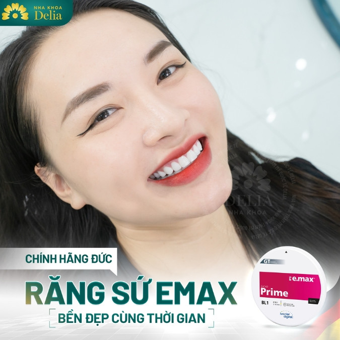 Đâu mới là dòng răng sứ tốt nhất được bác sĩ khuyên dùng để bọc răng sứ?