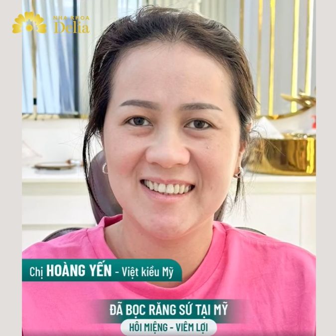 Hậu quả khôn lường khi bọc răng sứ 800k 