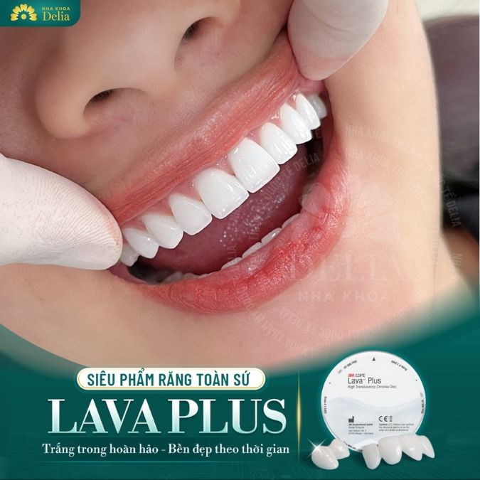 Đặc điểm nổi bật của răng sứ Lava Plus