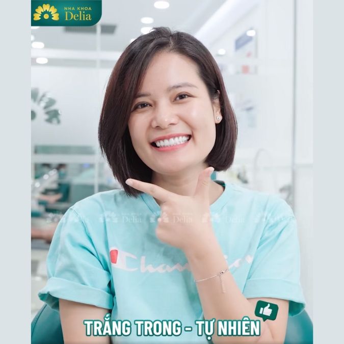 Khách hàng Bích Liên trải nghiệm làm răng sứ Lava Plus tại nha khoa Delia