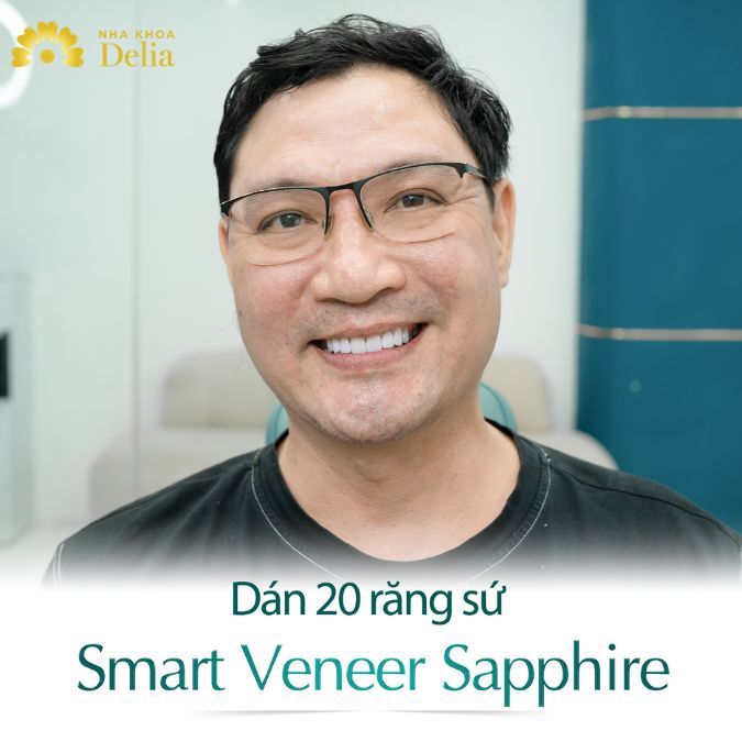 Smart Veneer Sapphire