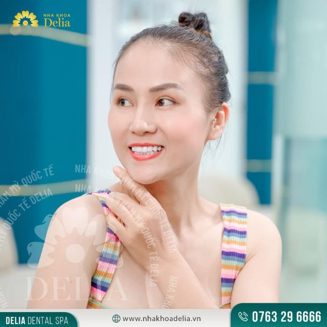 Khách hàng Uyên Dương Đỗ Vy trải nghiệm làm răng sứ Nacera tại nha khoa Delia