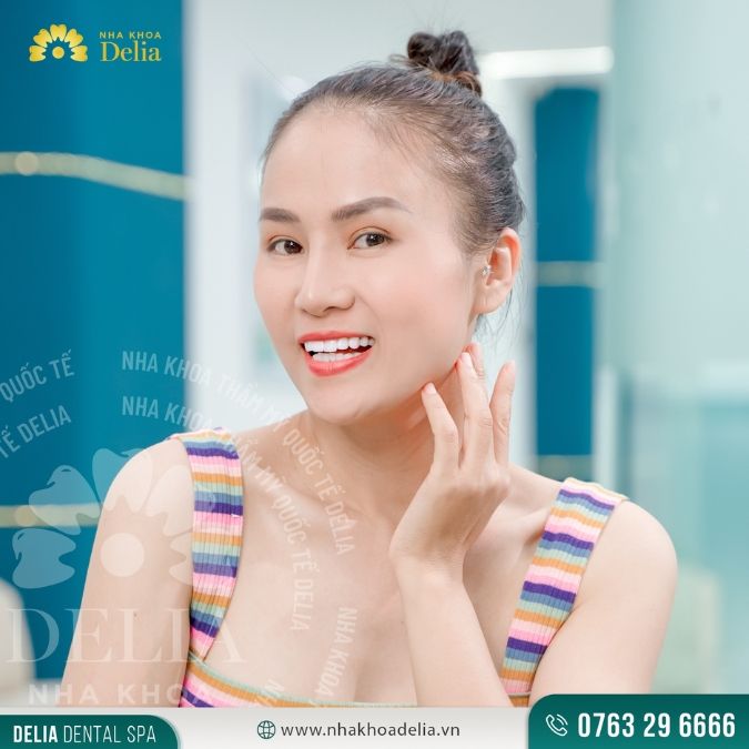 Khách hàng Đỗ Vy sau khi thẩm mỹ 20 răng sứ Nacera