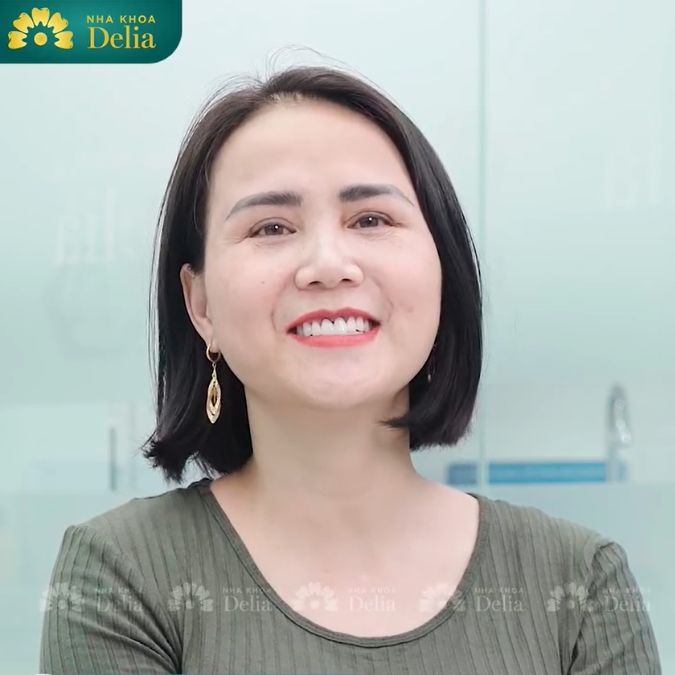 Khách hàng Thanh Mai trải nghiệm làm răng sứ Orodent Bleach tại nha khoa Delia