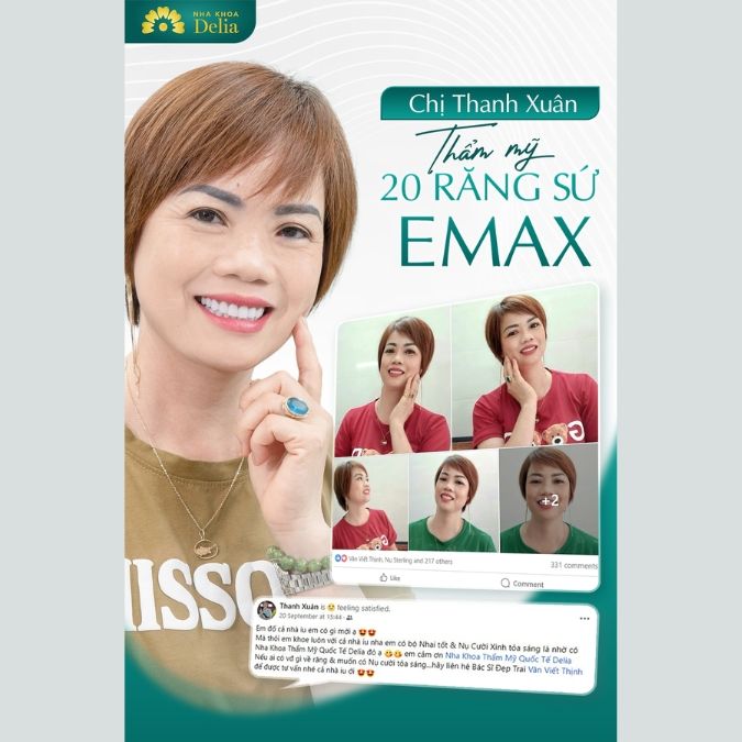Khách hàng Thanh Xuân sau khi trải nghiệm làm răng sứ Emax tại nha khoa Delia
