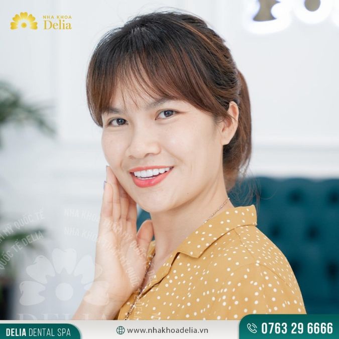 #Câu chuyện khách hàng: Chị Thu Hương – Thẩm mỹ 20 răng sứ Emax