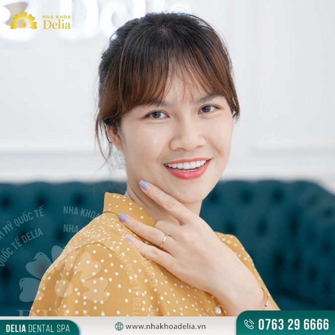 Khách hàng Thu Hương sau khi bọc 20 răng sứ Emax tại nha khoa Delia