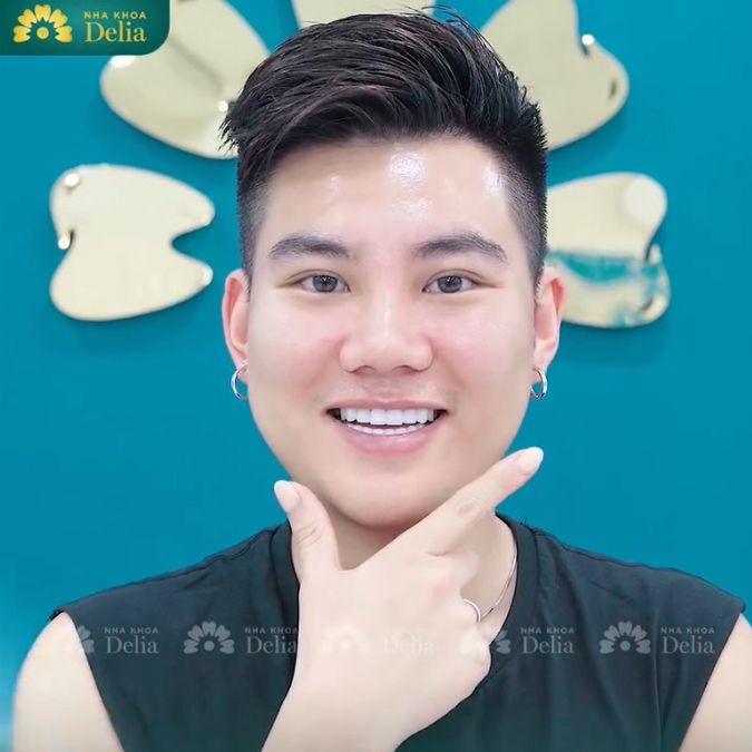 Khách hàng Trung Hiếu trải nghiệm làm răng sứ Emax tại nha khoa Delia
