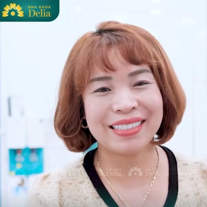 Kiều bào Kim Mun sau khi trải nghiệm làm 20 răng sứ Emax tại nha khoa Delia