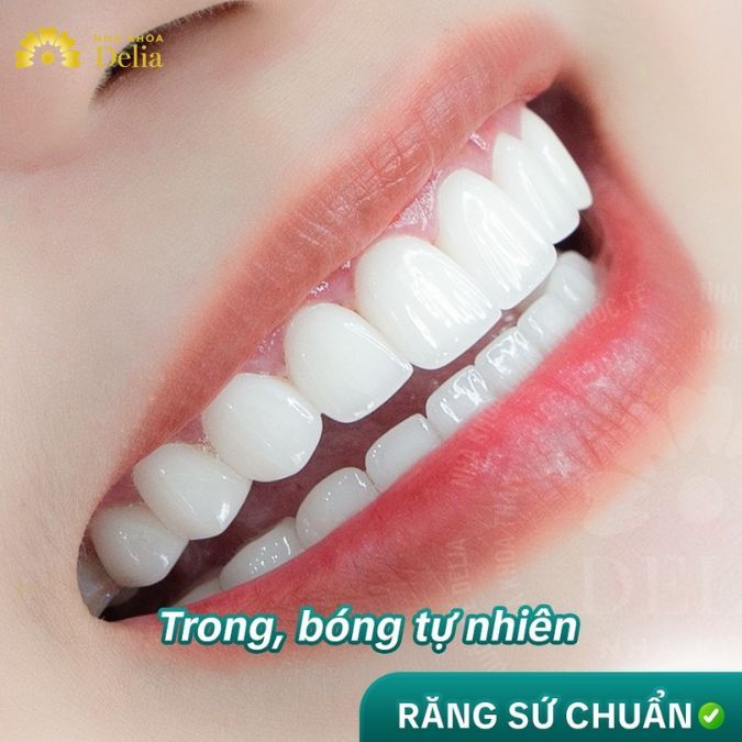 Răng sứ Demax - Dòng sứ cao cấp mà chị Kiều Diễm hài lòng 100% 