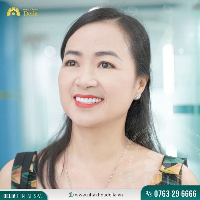 NSƯT Linh Huệ dán sứ Emax