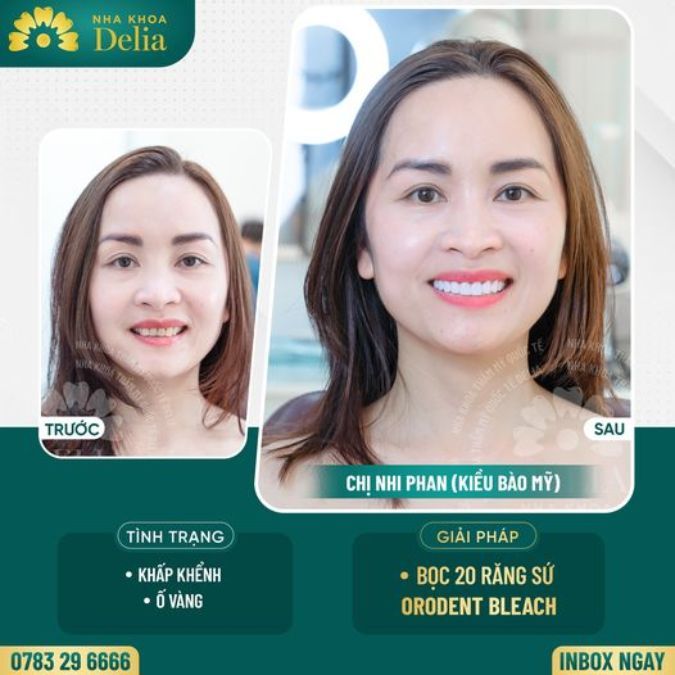 Độ bền răng sứ cao cùng khả năng bảo vệ răng gốc tránh khỏi việc mắc phải bệnh lý răng miệng