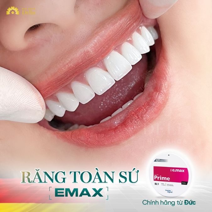 Răng sứ Emax