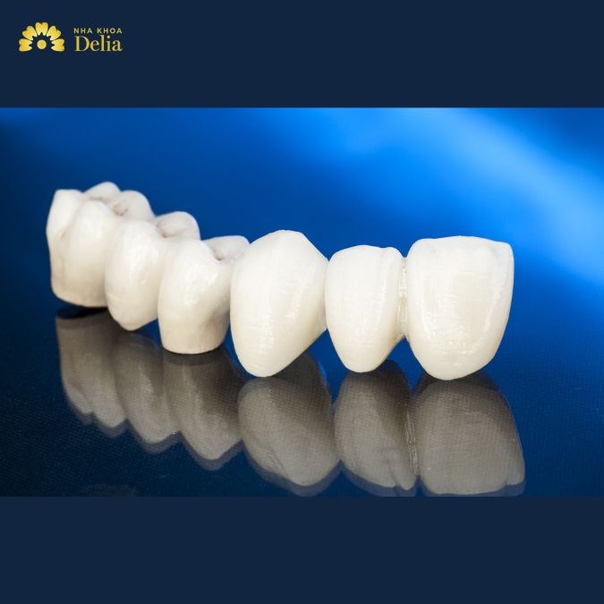 Mão răng sứ Ceramic