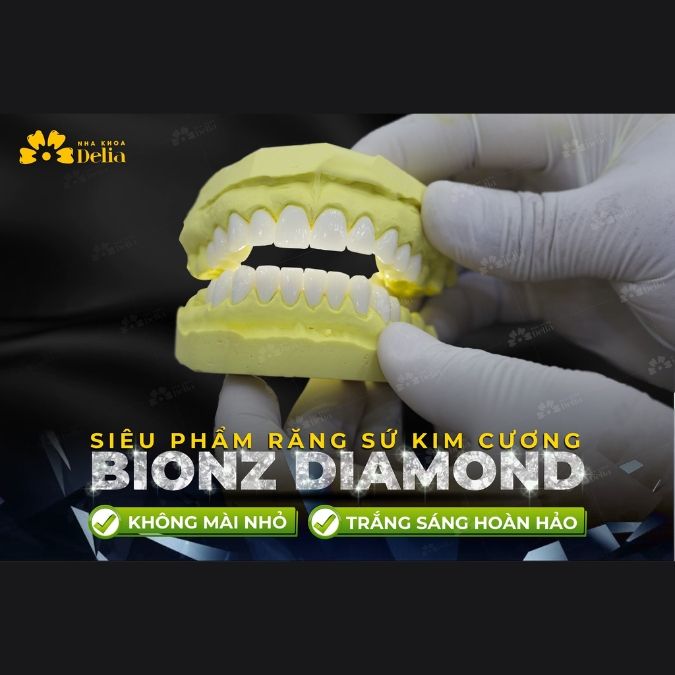 Lựa chọn răng sứ Diamond - Giá thành phải đi kèm với chất lượng