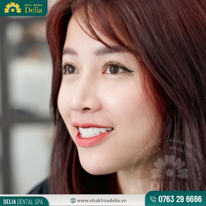 Răng sứ Đức chất lượng như thế nào? Giá răng sứ Đức có đắt không?