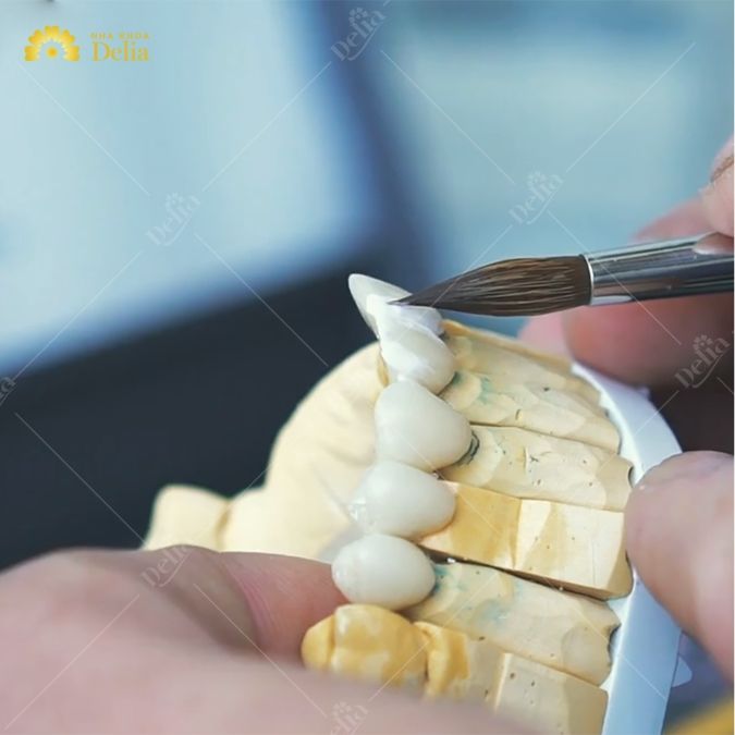 Bọc răng sứ Katana