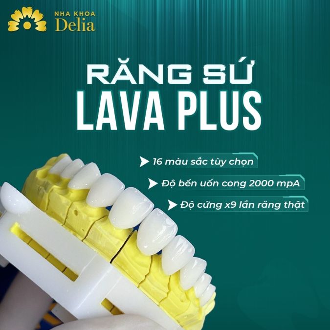 Có nên dùng răng sứ Mỹ không?