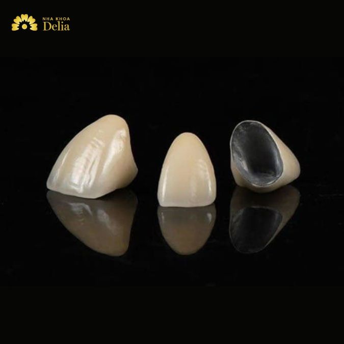 Ưu điểm của răng sứ kim loại Mỹ
