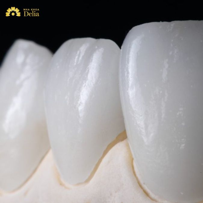 Tại sao bọc sứ Sage bị đau răng?