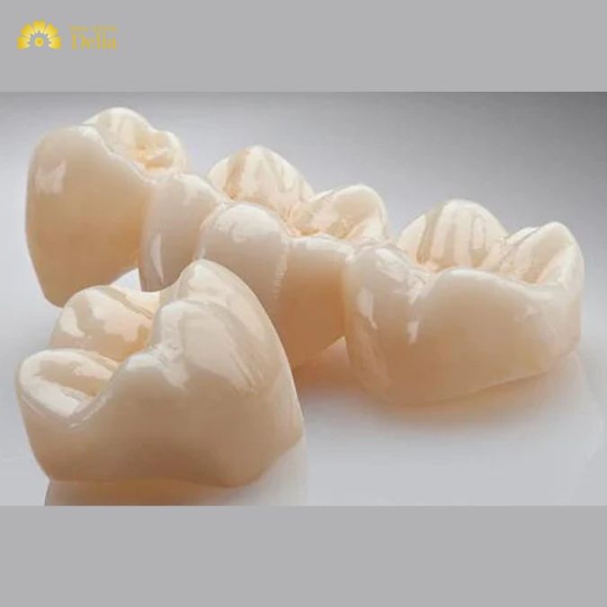 Nhược điểm nổi bật của sứ Sage