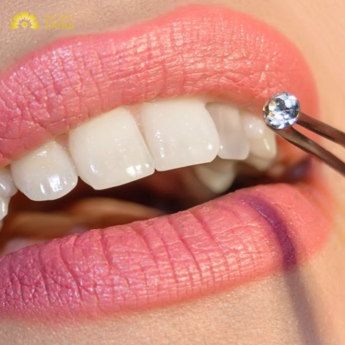 4 Ưu điểm nổi bật của răng toàn sứ Sapphire
