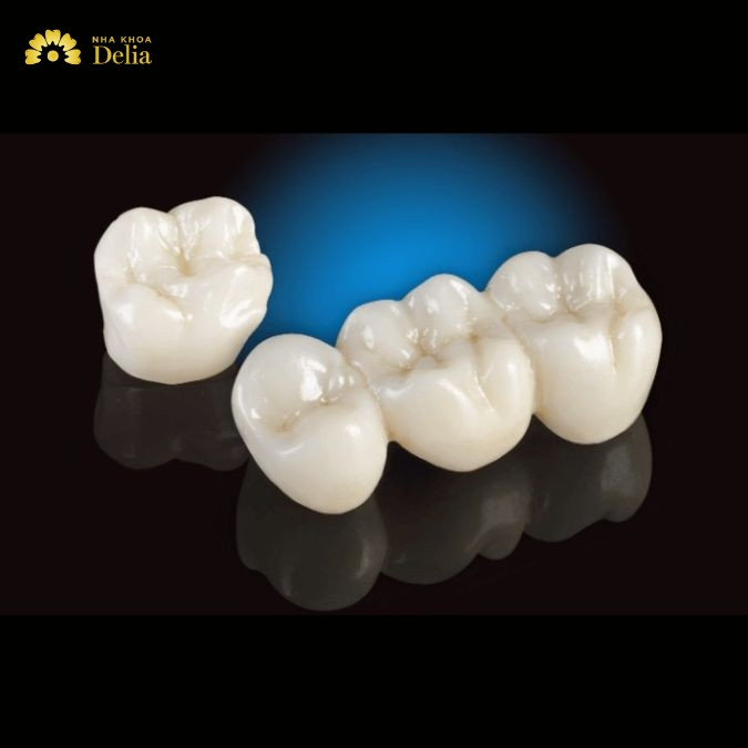 Răng sứ titan có mấy loại? Phân biệt các loại răng sứ titan