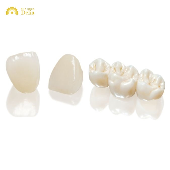Răng sứ titan có mấy loại? Phân biệt các loại răng sứ titan
