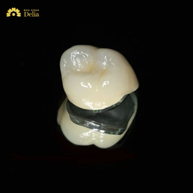 Răng sứ titan có mấy loại? Phân biệt các loại răng sứ titan
