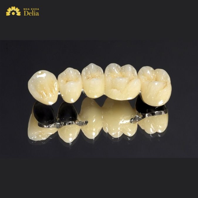 Răng sứ Trung Quốc giá rẻ có phải là răng sứ kém chất lượng?