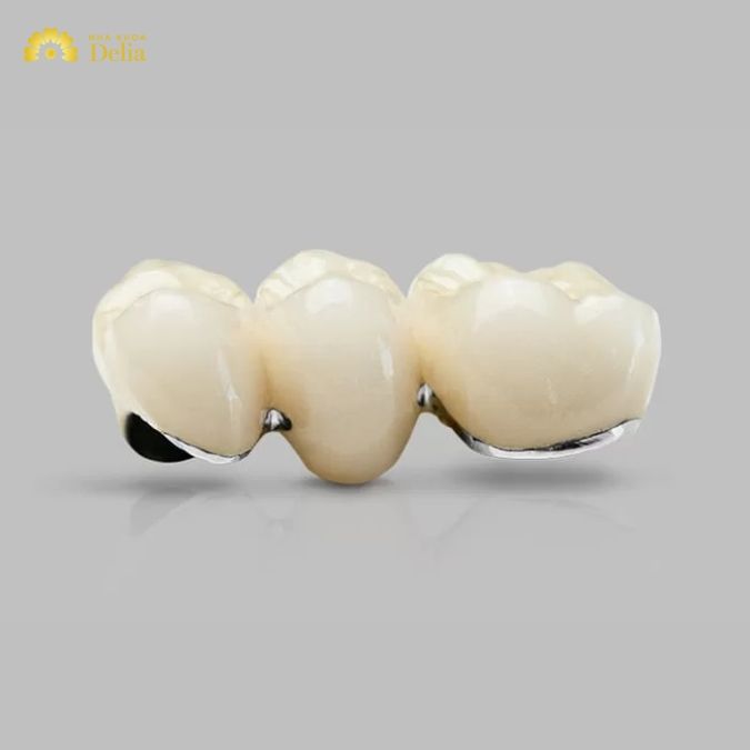 Độ bền chắc của răng toàn sứ và răng sứ kim loại