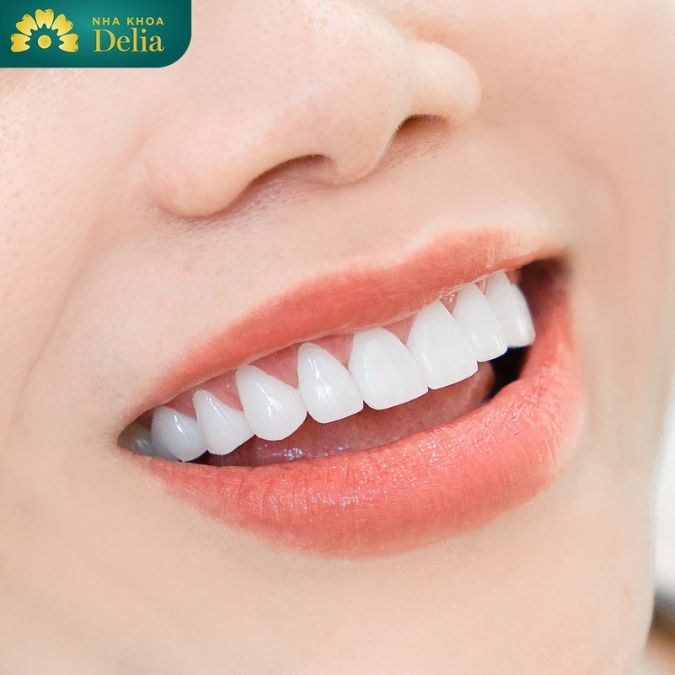 Độ bền chắc của răng toàn sứ và răng sứ kim loại