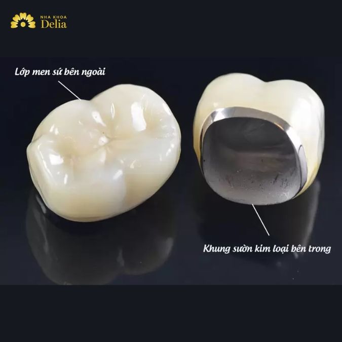 Chất liệu chế tác răng toàn sứ và răng sứ kim loại