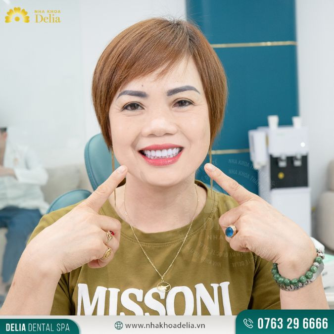 Răng sứ Lava Plus