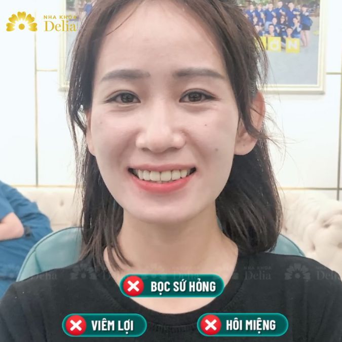 Sau khi thăm khám tại Delia, chị Mai quyết định thẩm mỹ 20 răng sứ HT Smile