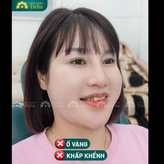 Sự đồng hành của chồng tiếp thêm động lực cho chị Hằng kiếm tìm nụ cười hoàn hảo đã mất