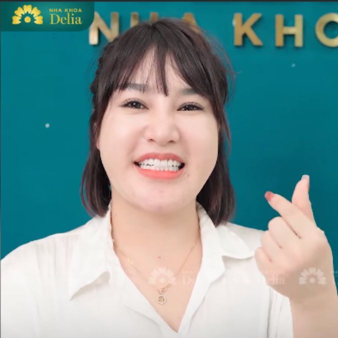 Răng sứ Lava Plus - Hoàn hảo và bền đẹp khiến chị Thu Hằng hài lòng 100%