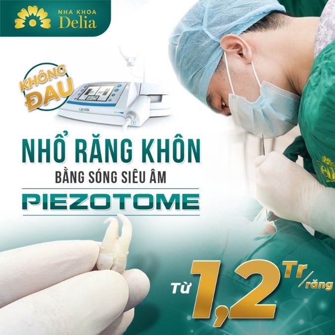 Nhổ răng khôn có đắt không?
